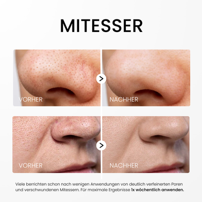 Rice Peel Glow Serum