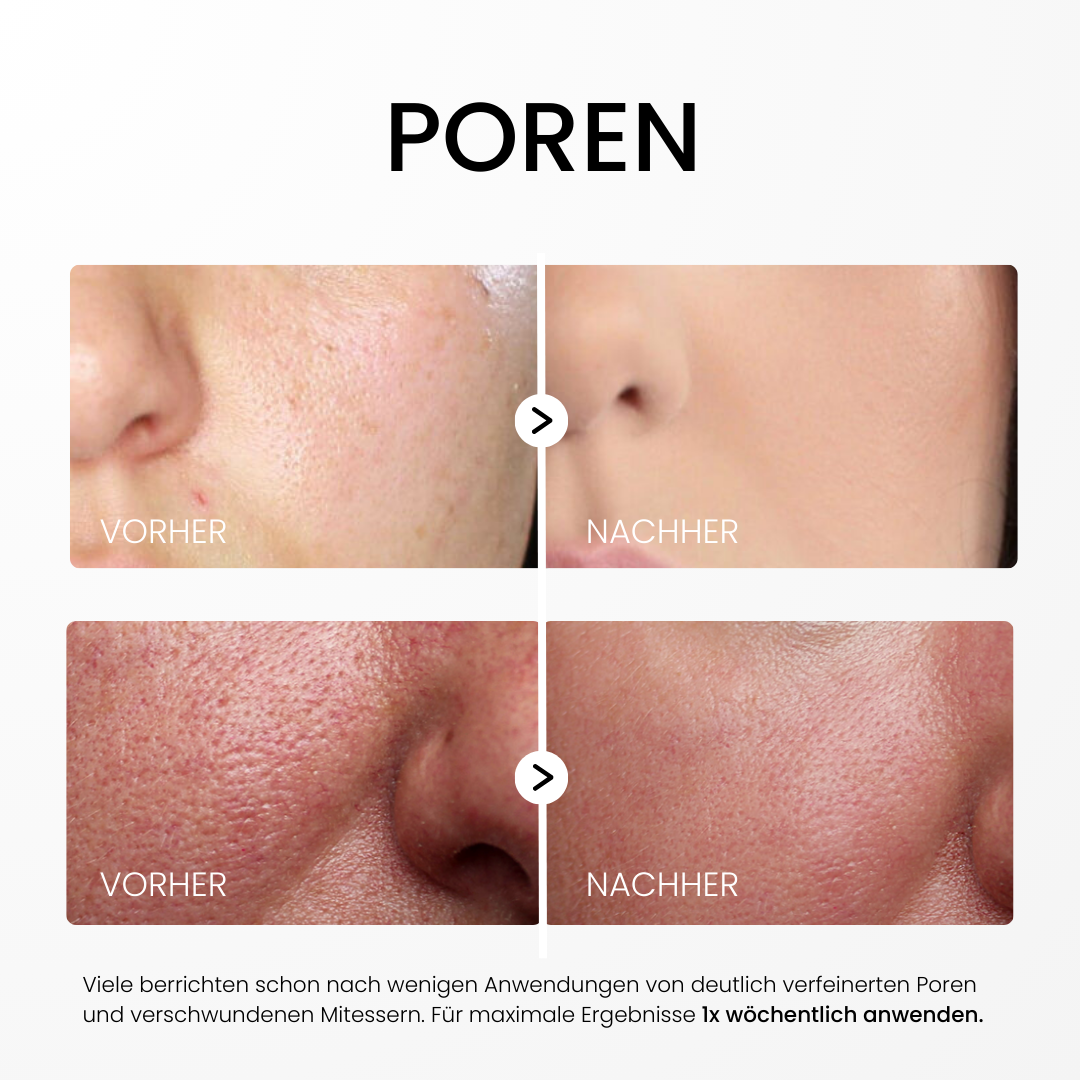 Rice Peel Glow Serum