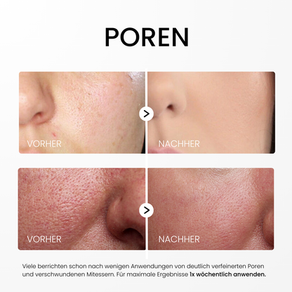 Rice Peel Glow Serum